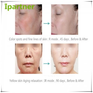 Heißer Verkauf LED Photon Therapie Beauty Equipment für die Hautpflege