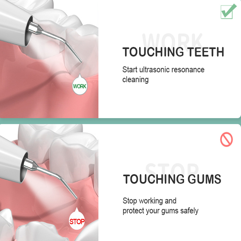 Home-Use Visualisierung Ultraschall zahnärztlicher Calculus-Reiniger, eingebaute Hochdefinitionskamera und LED-Licht mit 3 Modi der Reinigungszähne